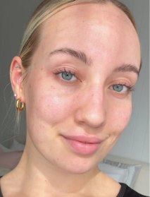 אחרי שימוש אחד בלבד